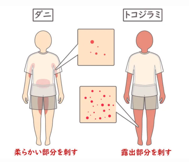 トコジラミとダニの症状の違い